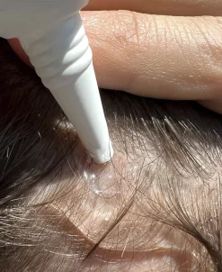 Hair Activator - Hårstimulerende serum