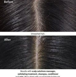 Scalp Solutions Stimulating Scalp Massager