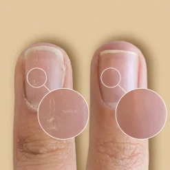 SolarOil Nail Care 14,78 ml.